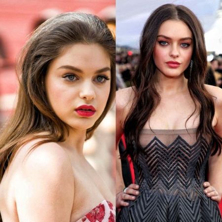 Odeya Rush plastic surgery